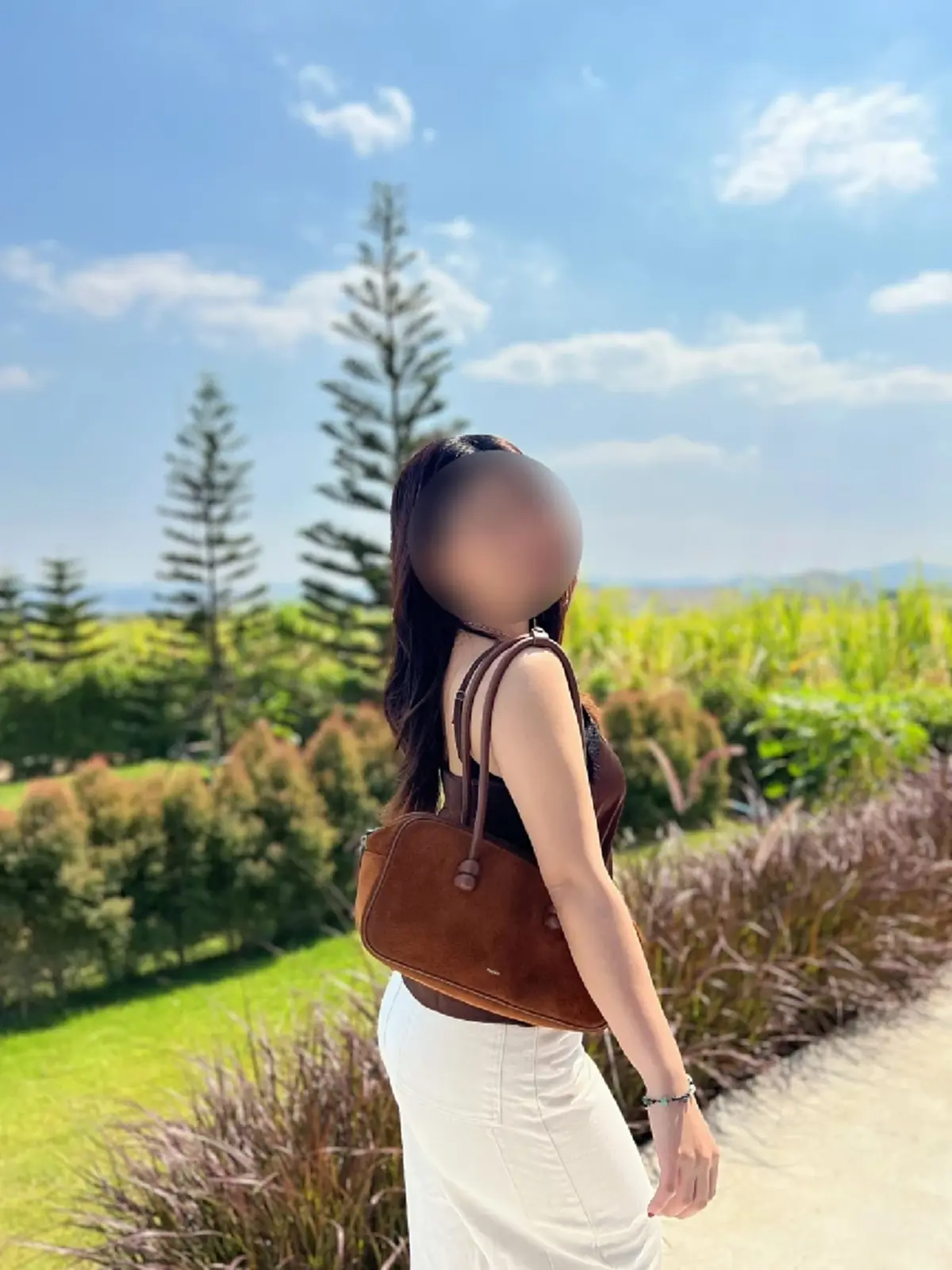 สาวนึกว่าตัวเองอ้วน เจอเนื้องอกมดลูก เตือนอาการที่ห้ามชะล่าใจ