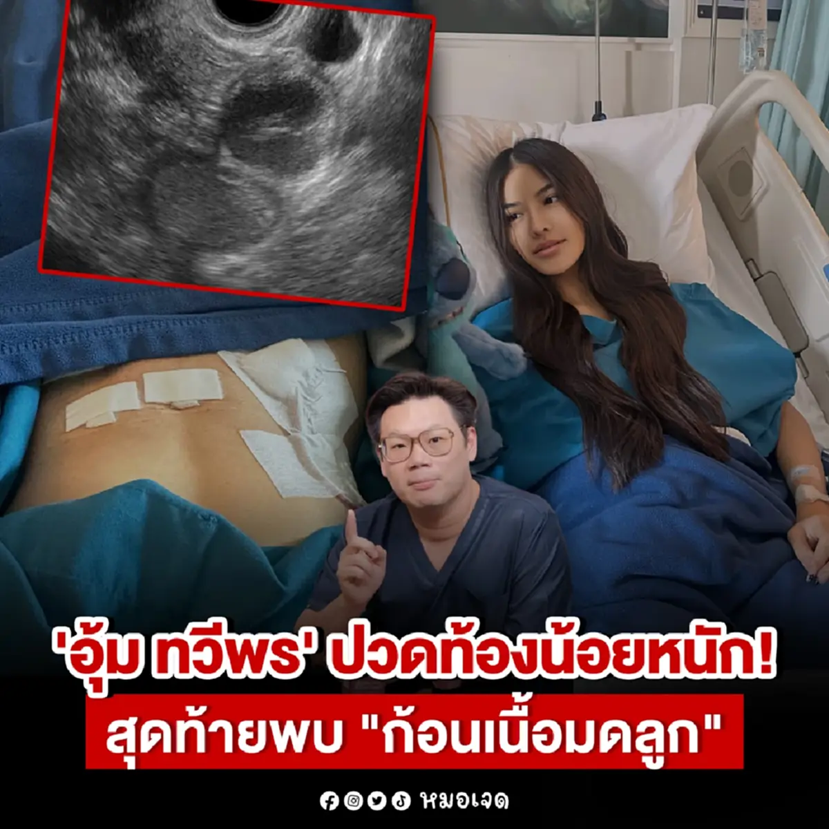 ใครมีอาการนี้ ไปตรวจด่วน หลัง นางงามดัง ตรวจเจอ ก้อนเนื้อมดลูก