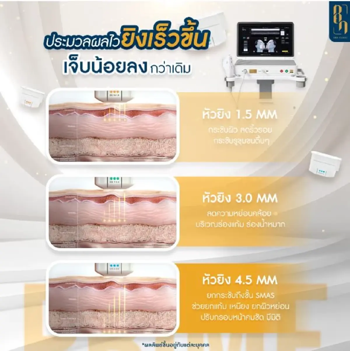 หน้าหย่อนคล้อย แก้ยังไง