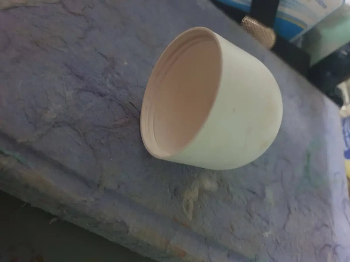 ผู้ป่วยมีสิ่งแปลกปลอมติดในช่องคลอด บางชิ้นหมอก็เพิ่งเคยเจอ