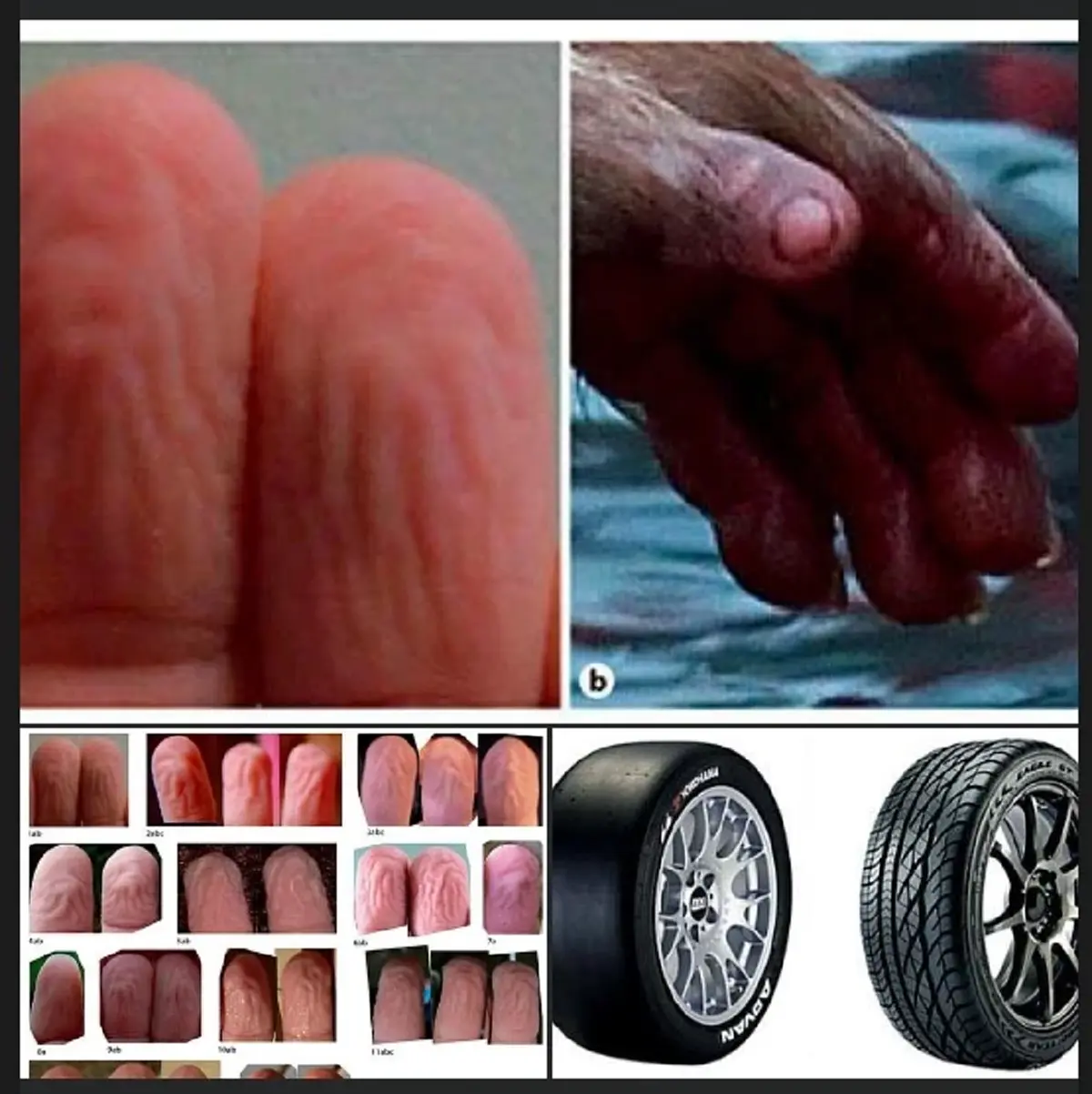 เข้าใจผิดหมด สาเหตุแท้จริง "มือเหี่ยวตอนโดนน้ำ" บอกเลยมันดีมาก 