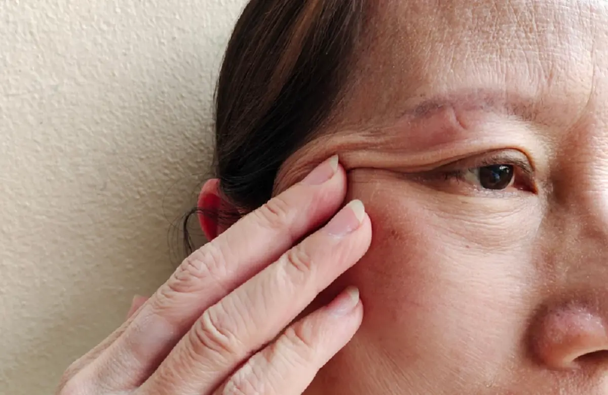 ดึงหางตา