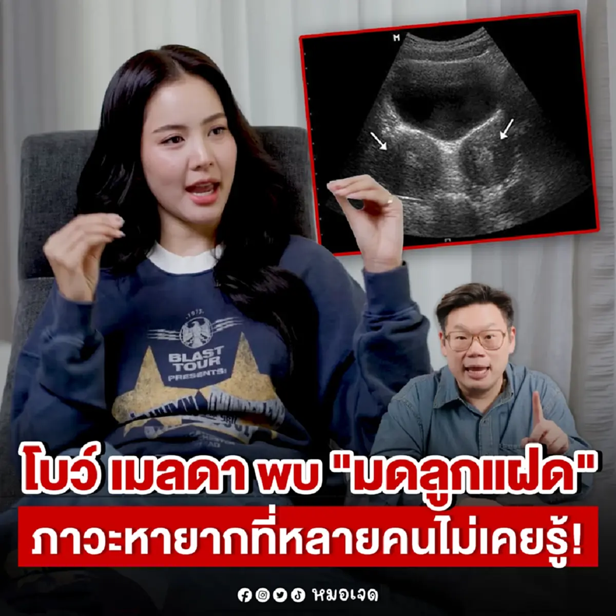รู้จัก ภาวะ "มดลูกแฝด" ของ "โบว์ เมลดา" บางคนอาจมี แต่ไม่รู้ตัว 