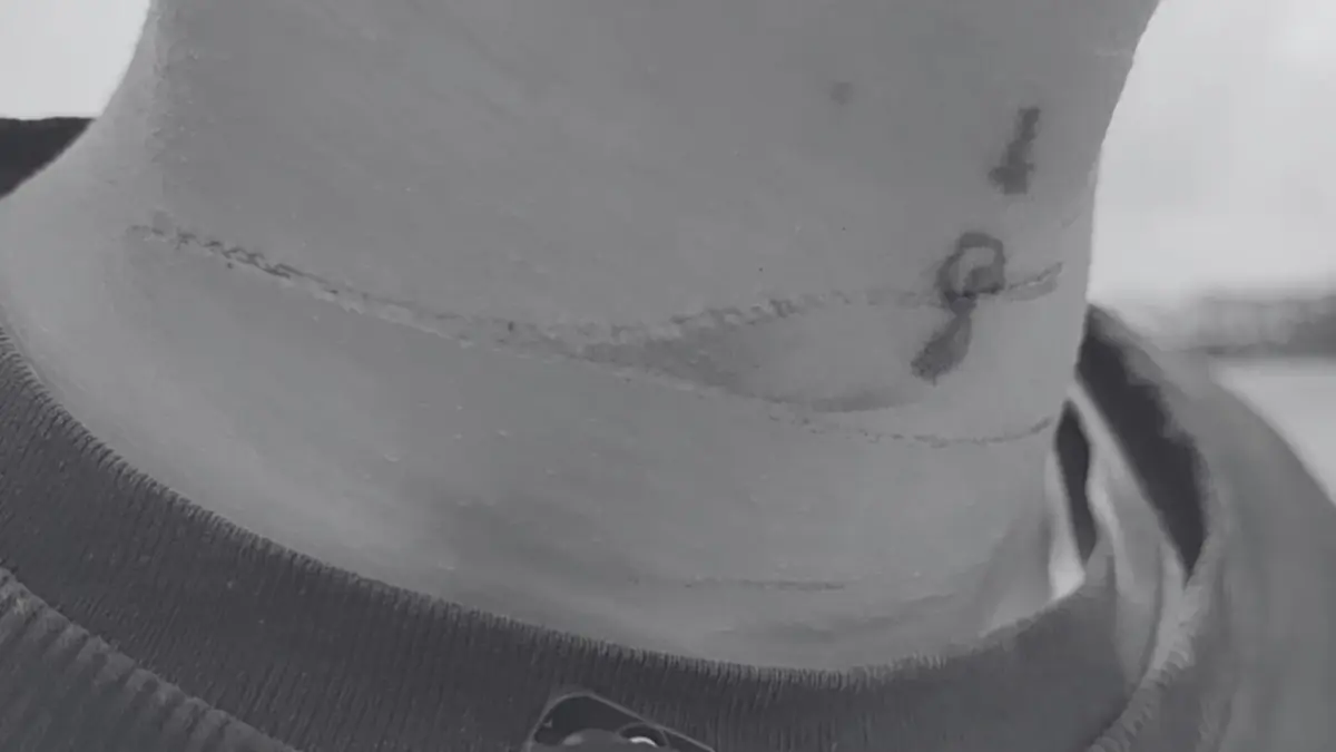 หนุ่ม 16 ลุยแจ้งความ หลังขี่มอเตอร์ไซค์เจอ "เชือกว่าว" รัดคอ