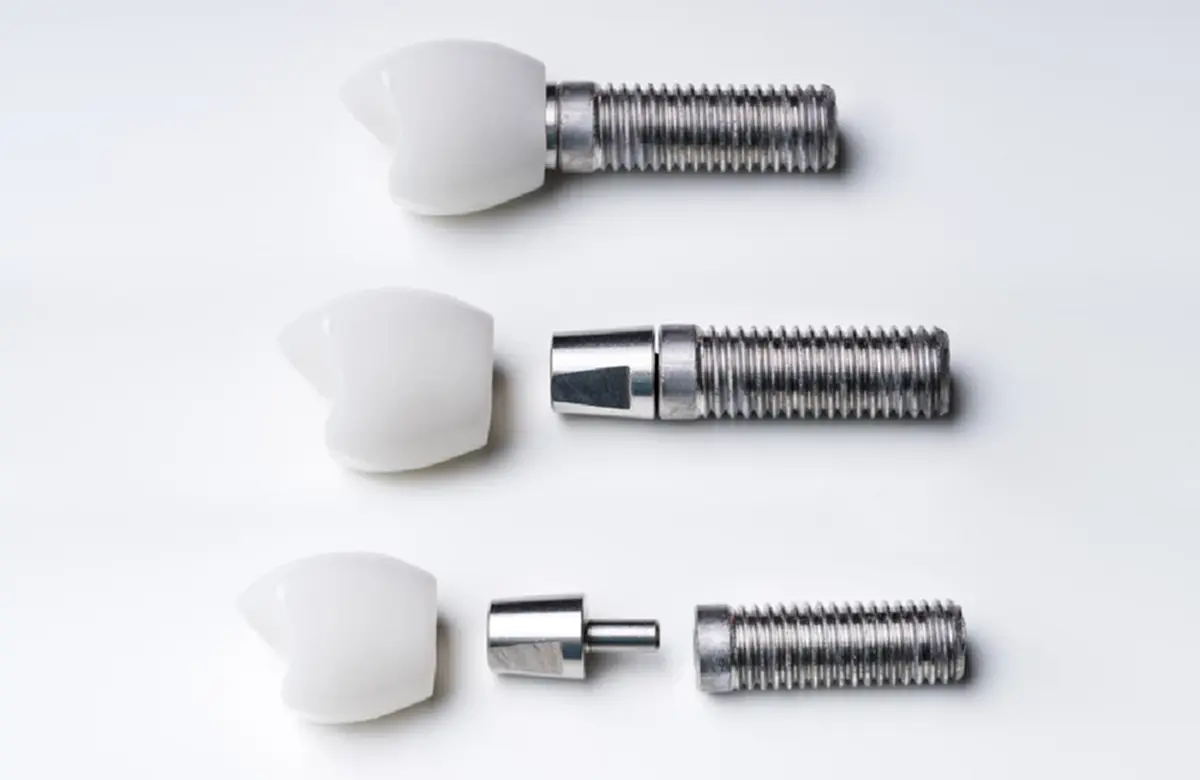 เจาะลึกทำรากฟันเทียม มีขั้นตอนอะไรบ้าง เตรียมงบเท่าไหร่ดี?