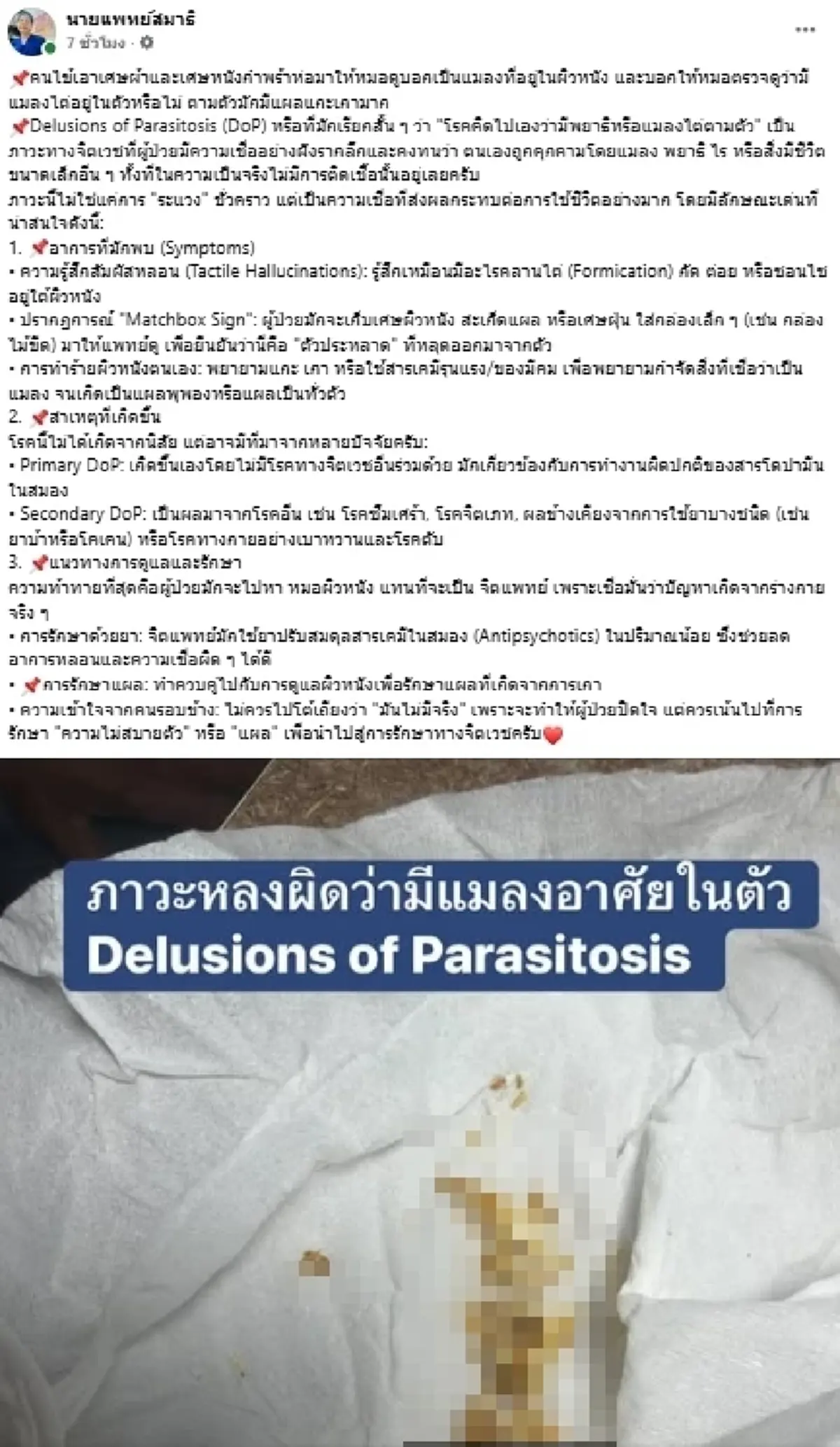 ตกใจ หมอเปิดเคสคนไข้หอบ "เศษผิว" ให้ดู อ้างมีแมลงไต่อยู่ในตัว