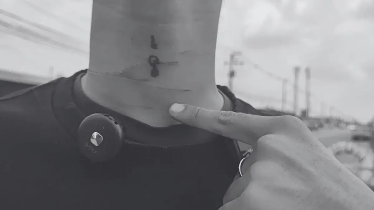 หนุ่ม 16 ลุยแจ้งความ หลังขี่มอเตอร์ไซค์เจอ "เชือกว่าว" รัดคอ