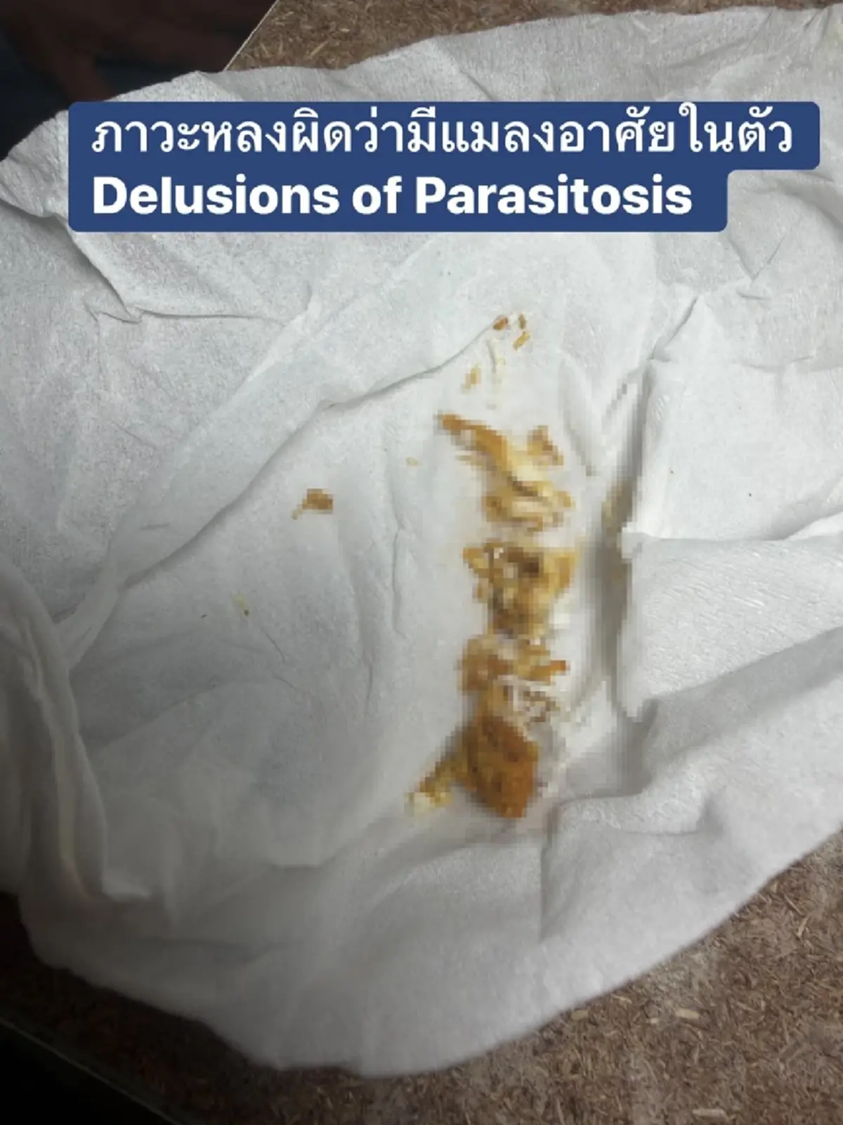 ตกใจ หมอเปิดเคสคนไข้หอบ "เศษผิว" ให้ดู อ้างมีแมลงไต่อยู่ในตัว