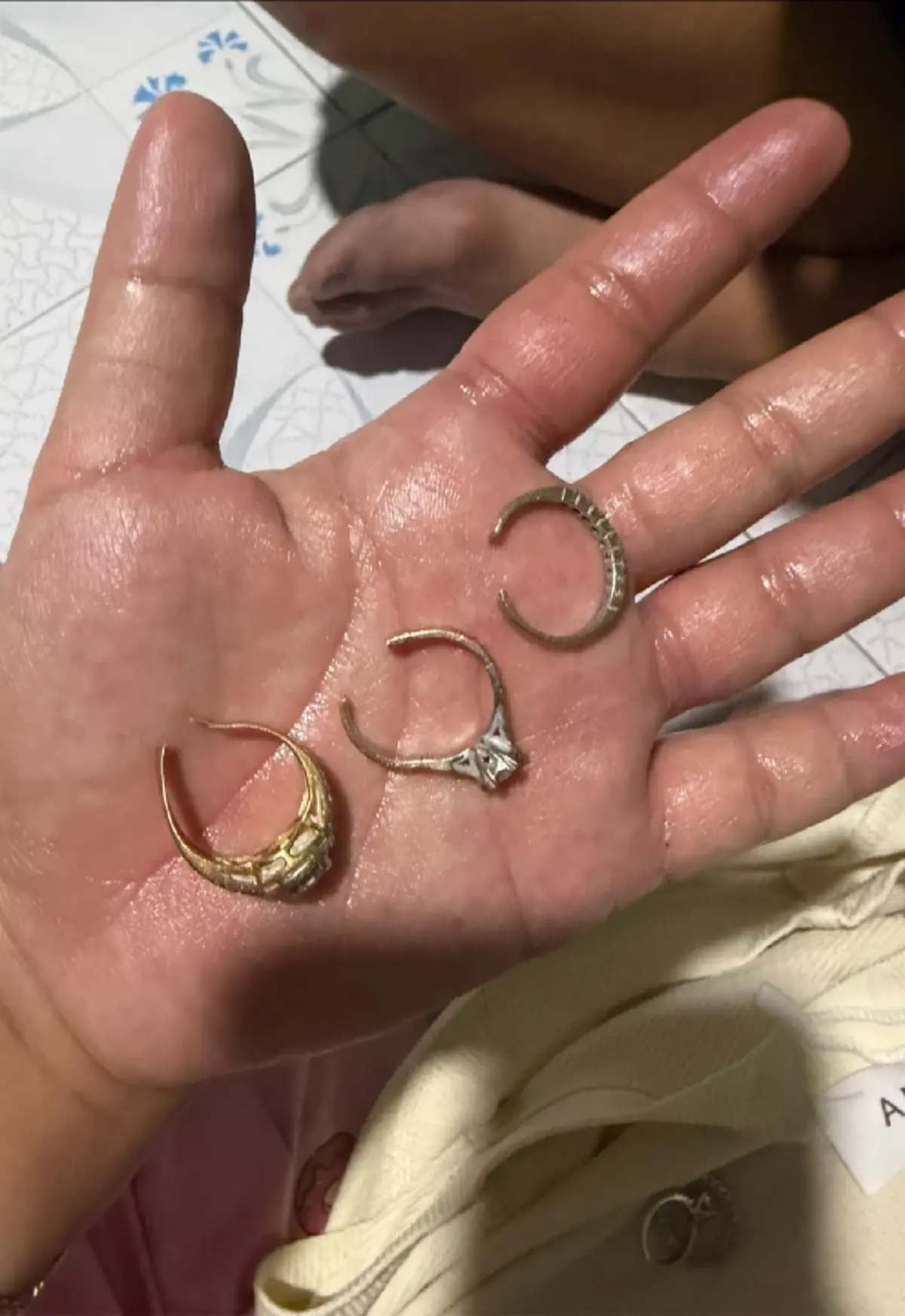 คุณแม่ท้องแฝด  เผยอาการสุดพีค ไตรมาสสุดท้าย แหวนแน่นจนถอดไม่ออก