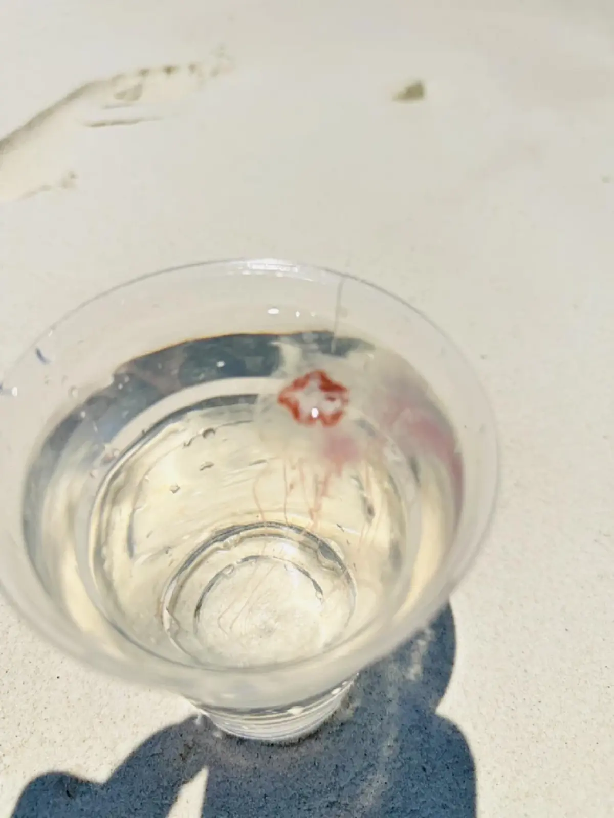 ภูเก็ตเตือนด่วน! แมงกะพรุนไฟบุกเกาะแอวหนาแน่น 100 ตัวต่อ ตร.ม.