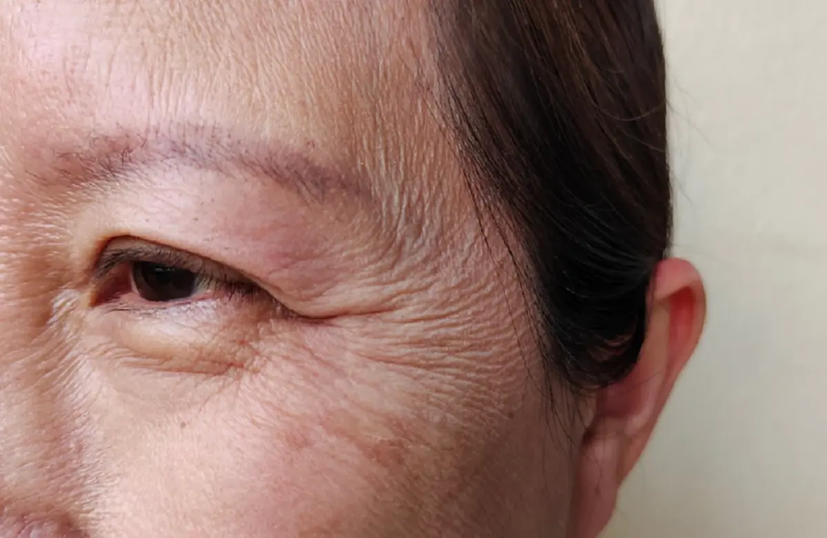 อายุเพิ่มขึ้น