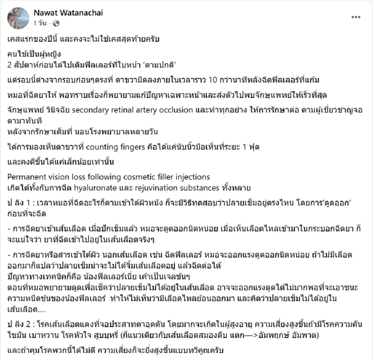 หมอเตือนภัย ฉีดฟิลเลอร์พลาด ตาขวามืดใน 10 นาที คงไม่ใช่เคสสุดท้าย