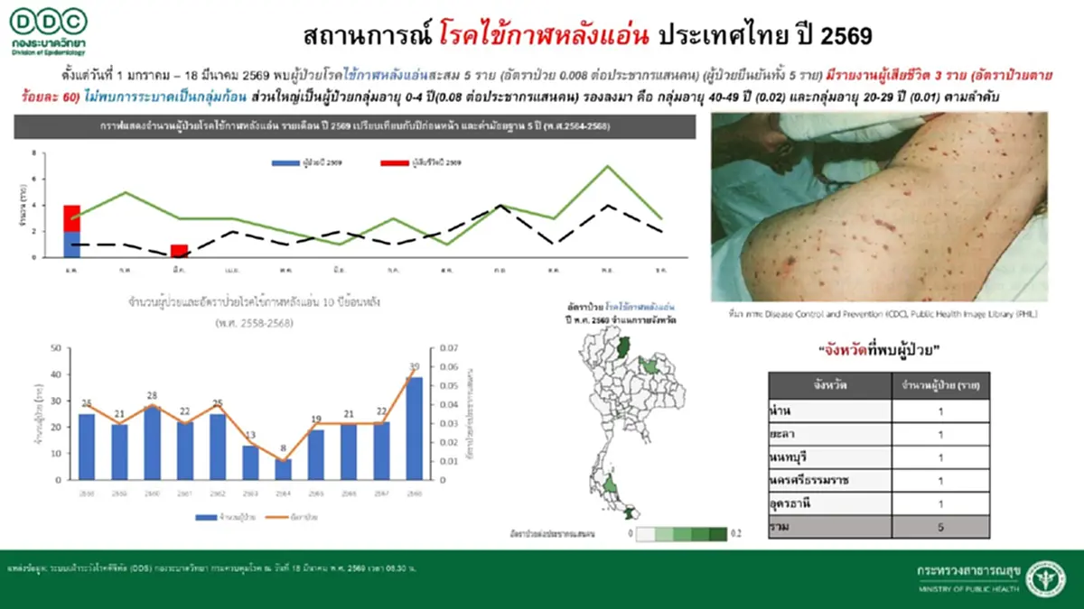 เช็กสถานการณ์ ไข้กาฬหลังแอ่น ปี 2569 พบผู้ป่วย 5 ราย เสียชีวิต 3 ราย