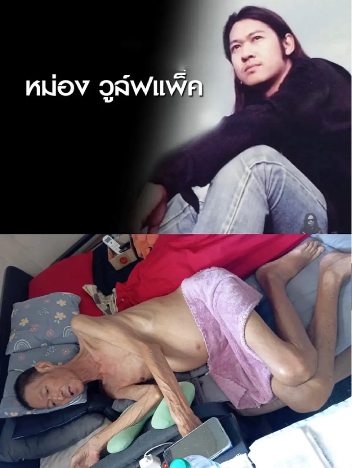 มือเบสวงร็อคยุค90 ป่วยตับแข็งระยะสุดท้าย วอนช่วยเหลือค่ารักษา