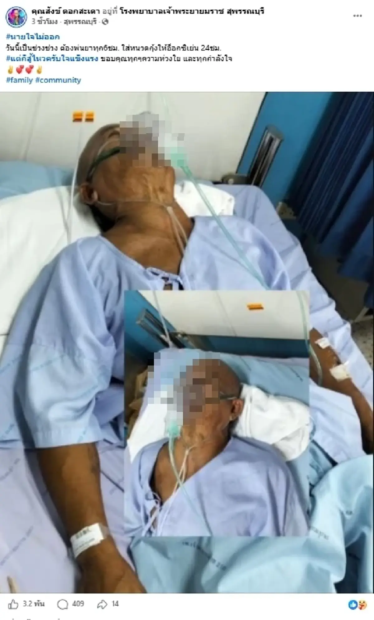 น่าห่วง ตลกดัง หายใจไม่ออก ใส่ออกซิเจน 24 ชม. หลังพบก้อนเนื้อในปอด