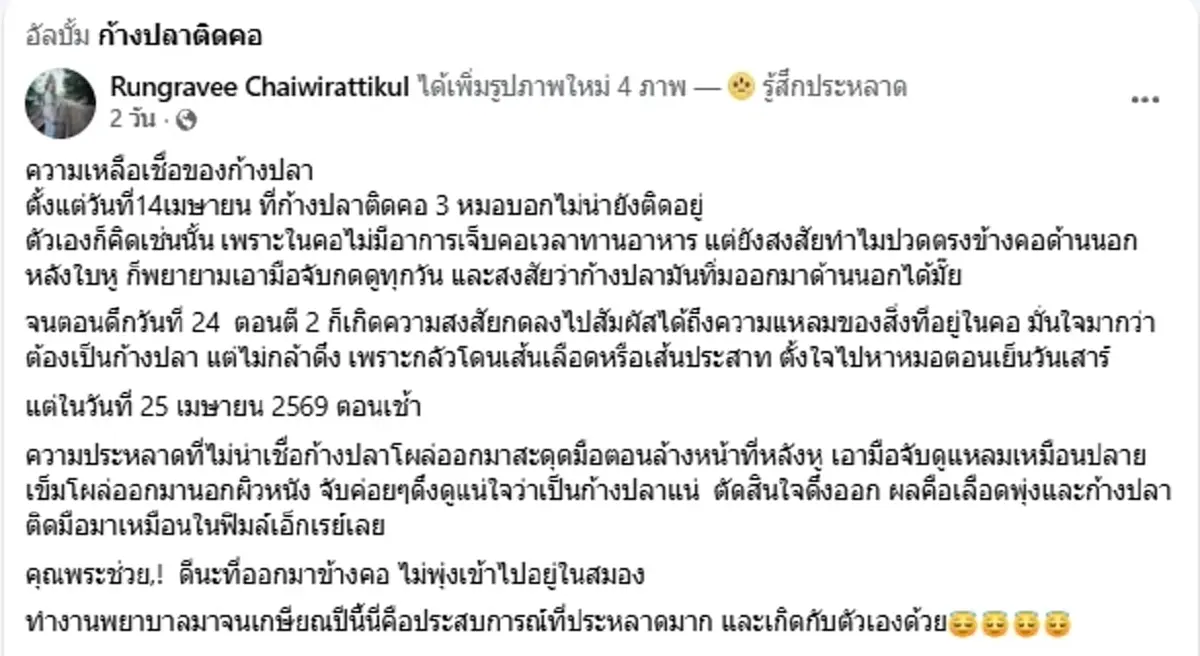 ขนลุก "ก้างปลาติดคอ" อยู่ๆ โผล่ทะลุหลังหู เพจดังเตือนอันตรายมาก