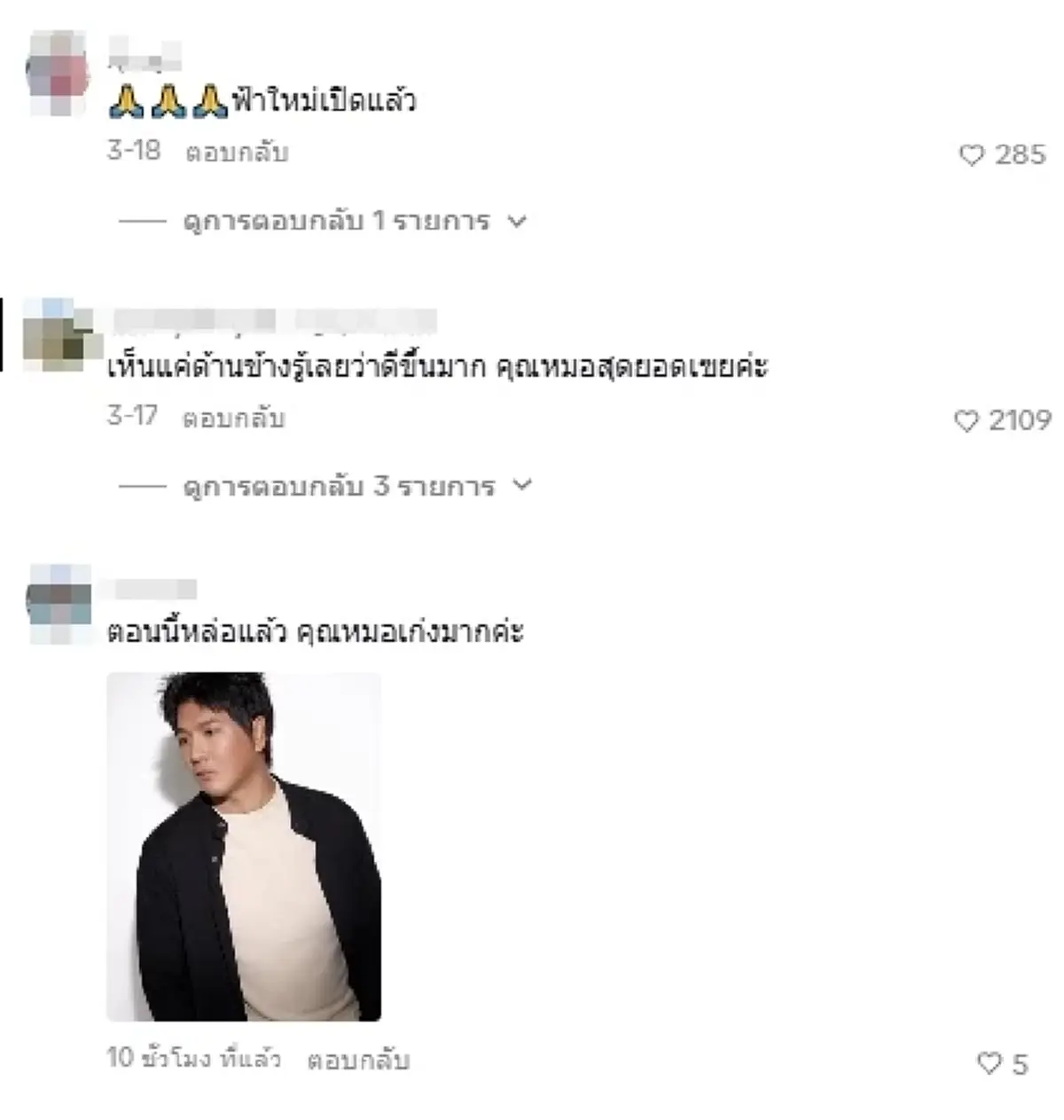 จำแทบไม่ได้ "น้องฟ้า โหนกระแส" ศัลยกรรม 4 ปี เหมือนได้เกิดใหม่