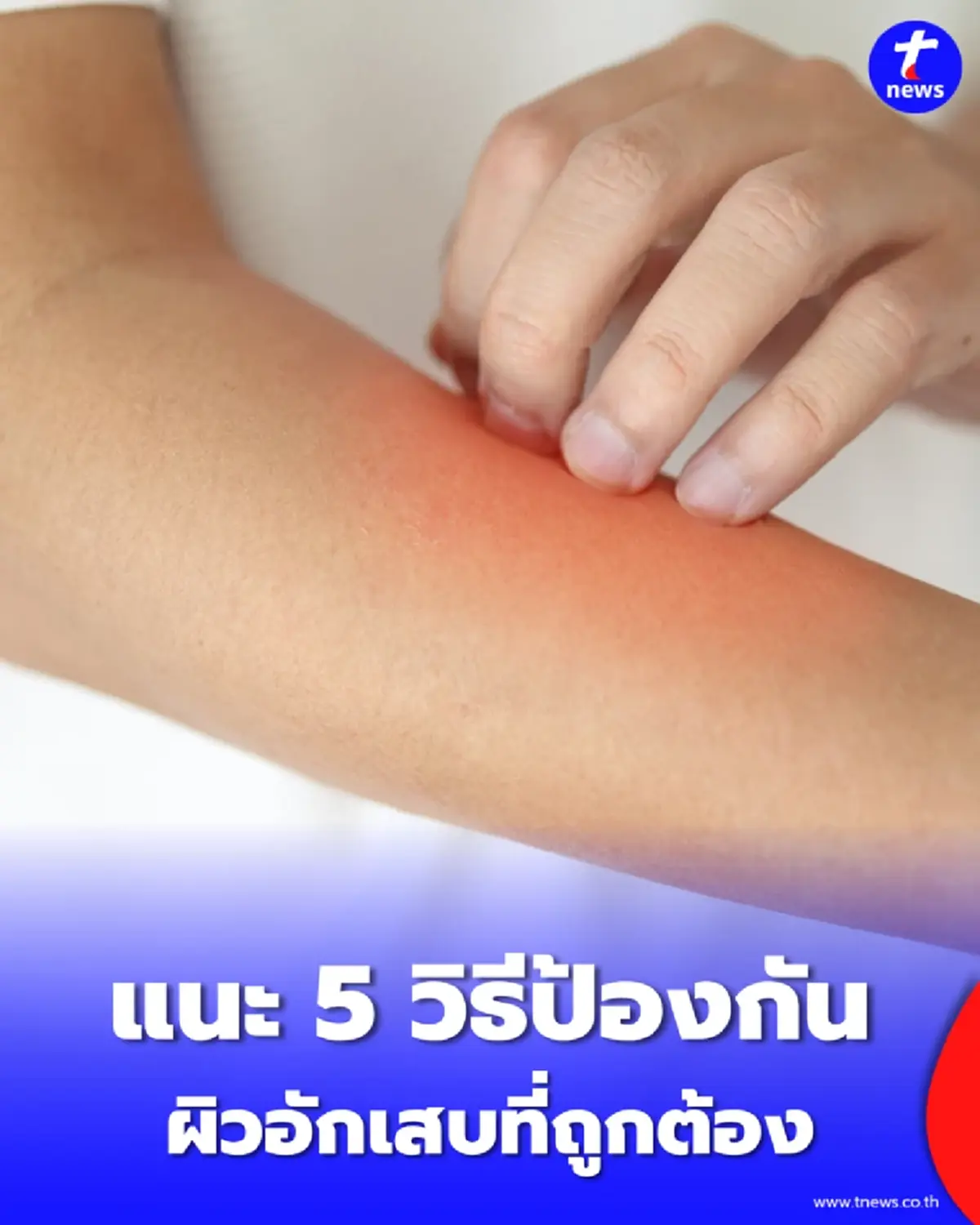 PM 2.5 ตัวการสิวเห่อ-ผื่นคัน เปิดวิธีป้องกันผิวอักเสบที่ถูกต้อง