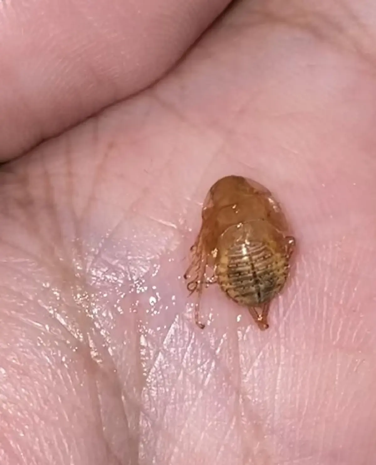 ขนหัวลุก นึกว่าแค่ระคายคอ สุดท้ายเจอ สัตว์สยอง ซ่อนอยู่ในร่างกาย