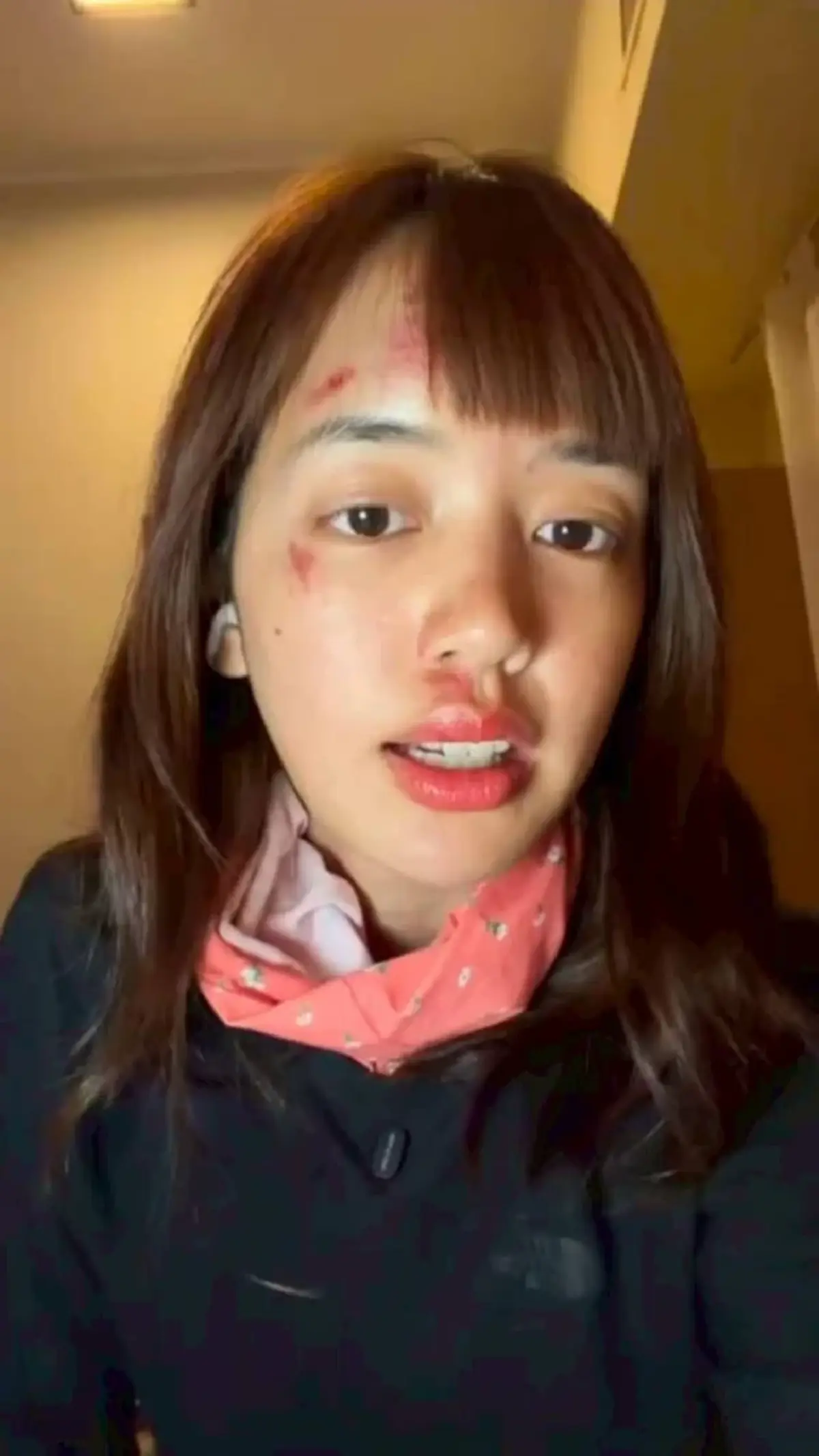 เห็นแล้วตกใจ พลอย พิกกะพลอย เผยสาเหตุหน้าเยิน หลังล่องเรือใน ตปท.