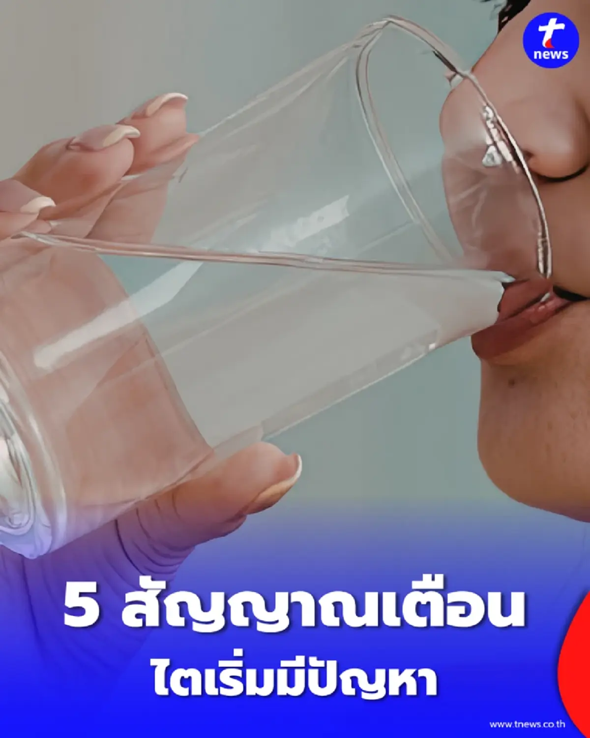 กรมการแพทย์เตือน โรคไต ภัยเงียบไร้อาการ เช็กสัญญาณก่อนสายเกิน