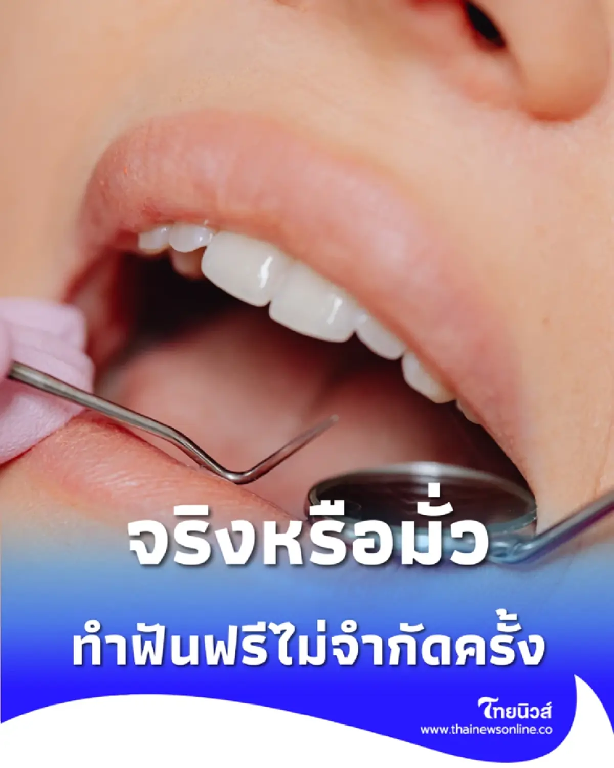 จริงหรือไม่ ประกันสังคมทำฟันฟรีไม่จำกัดครั้ง ดีอีเปิดโผ 7 ข่าวเด่น