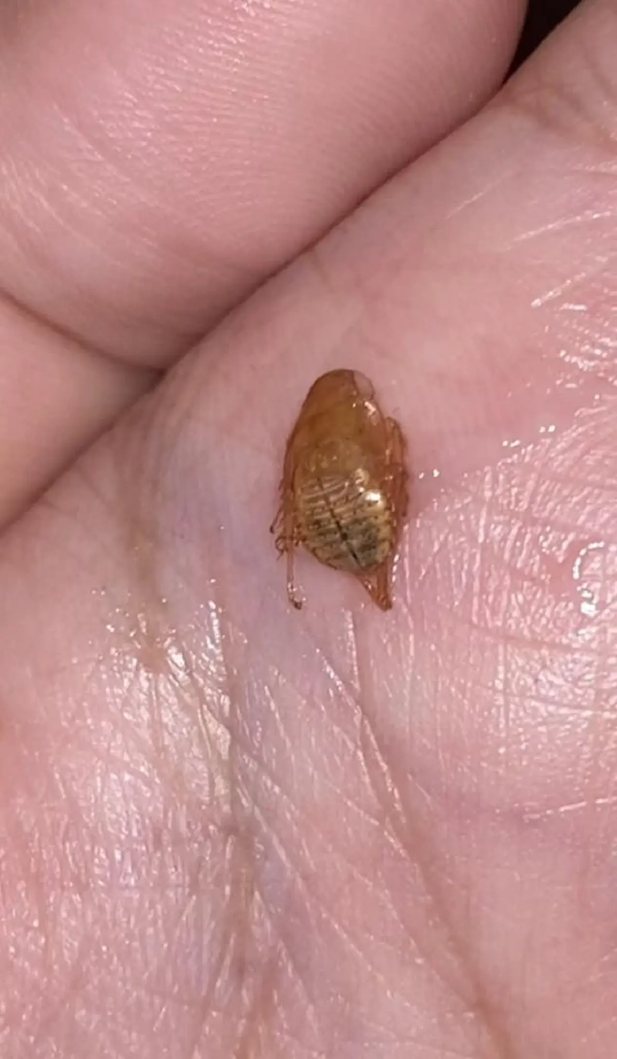 ขนหัวลุก นึกว่าแค่ระคายคอ สุดท้ายเจอ สัตว์สยอง ซ่อนอยู่ในร่างกาย