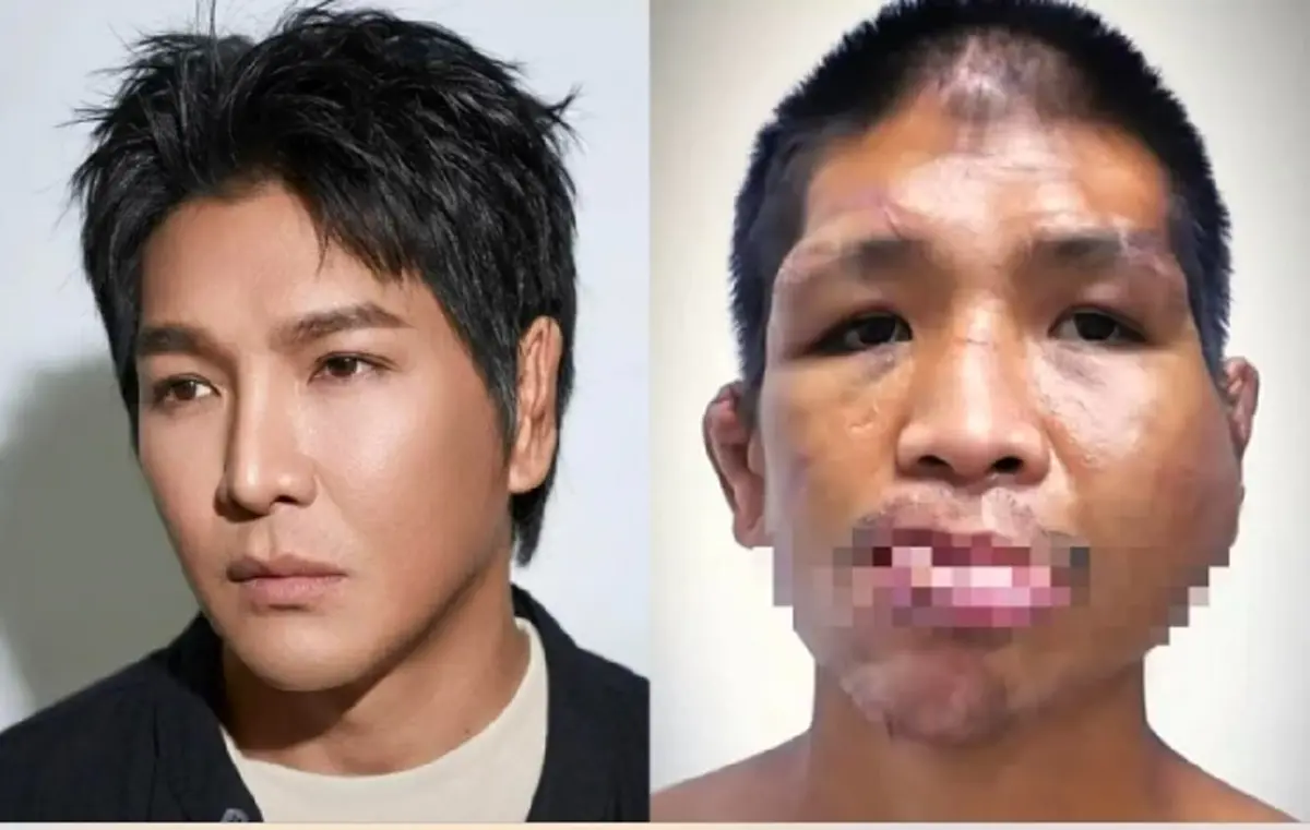 ผู้ปิดทองหลังพระ หนุ่ม กรรชัย โพสต์แล้ว หลังน้องฟ้าได้ชีวิตใหม่