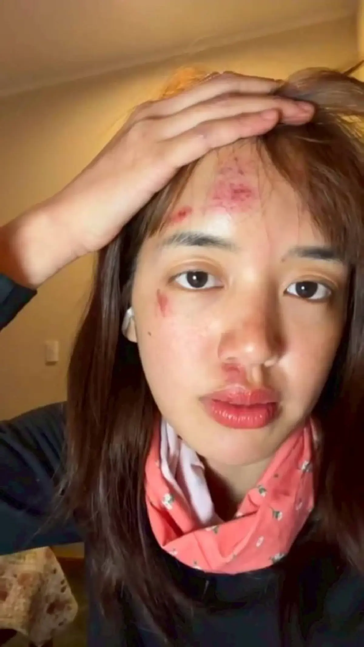 เห็นแล้วตกใจ พลอย พิกกะพลอย เผยสาเหตุหน้าเยิน หลังล่องเรือใน ตปท.