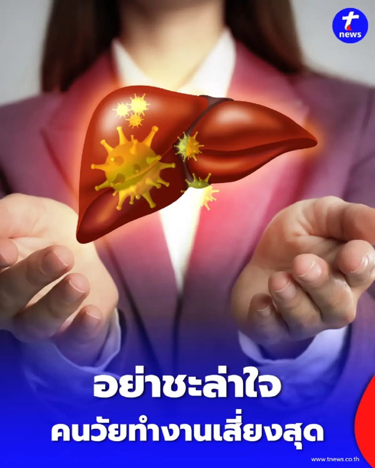 แค่กินร่วมกันก็ติด ยอดปี 69 พุ่ง 651 ราย วัยทำงานเสี่ยงสุด