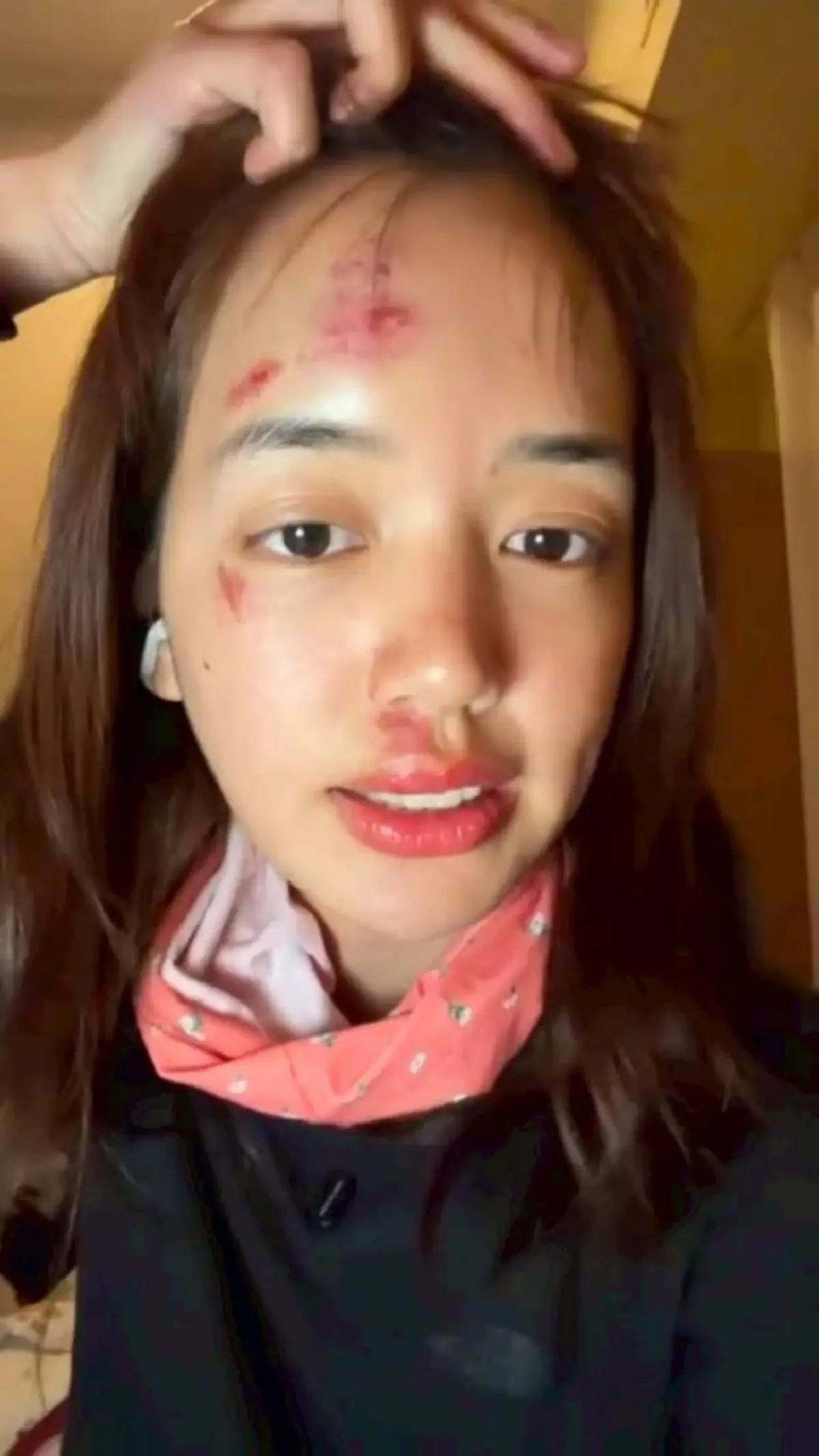 เห็นแล้วตกใจ พลอย พิกกะพลอย เผยสาเหตุหน้าเยิน หลังล่องเรือใน ตปท.