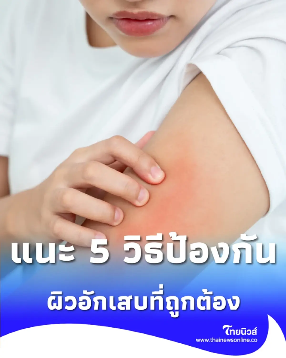 PM 2.5 ตัวการสิวเห่อ-ผื่นคัน เปิดวิธีป้องกันผิวอักเสบที่ถูกต้อง