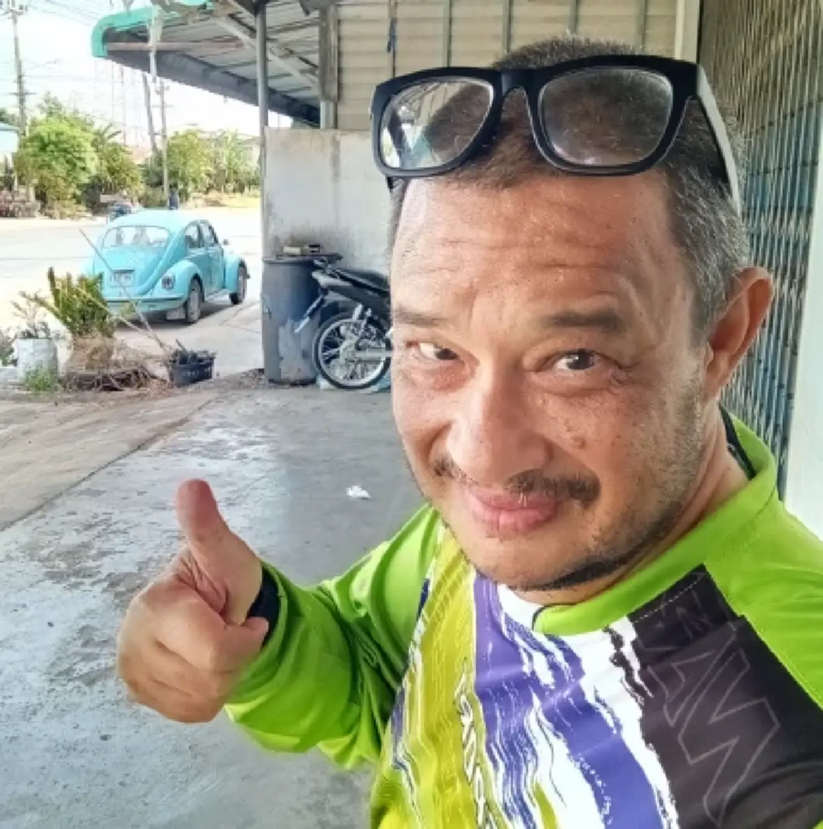 ตกใจเห็นสีกระดูก "แดนนี่ ศรีภิญโญ" ภรรยาเผยสาเหตุยิ่งสงสาร