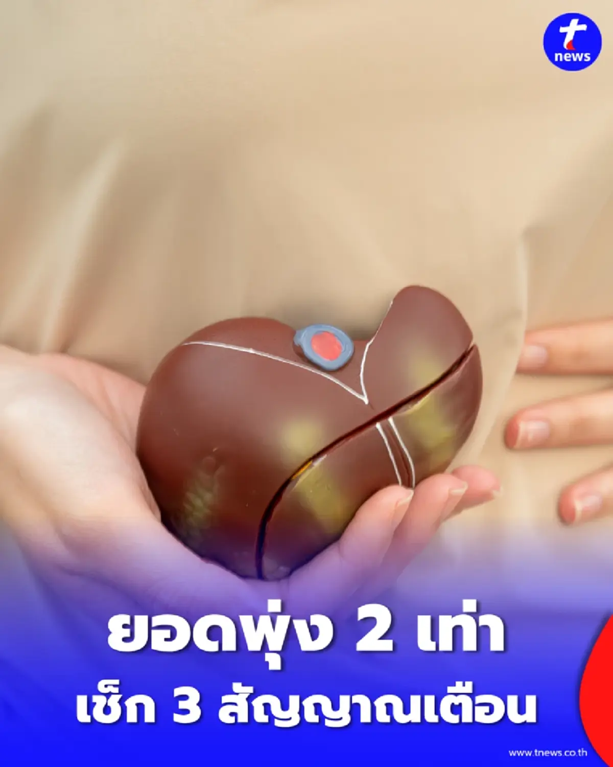 สธ.เตือนตับอักเสบเอระบาด เช็ก 3 สัญญาณเตือน ให้รีบพบแพทย์