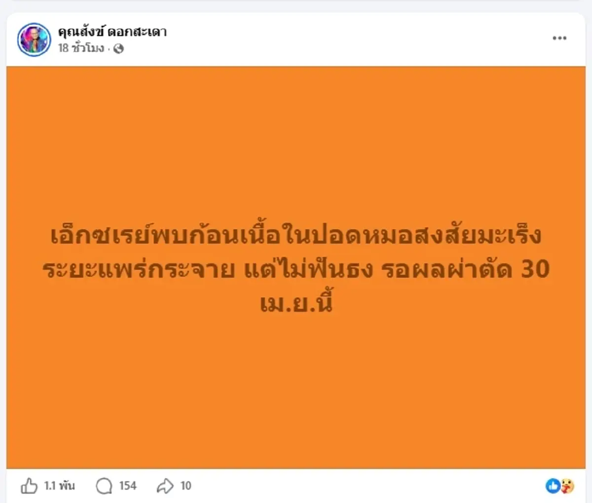 ส่งกำลังใจ "ตลกดัง" จู่ ๆ แน่นอก หายใจไม่ออก รู้สาเหตุรอลุ้นผ่าตัด