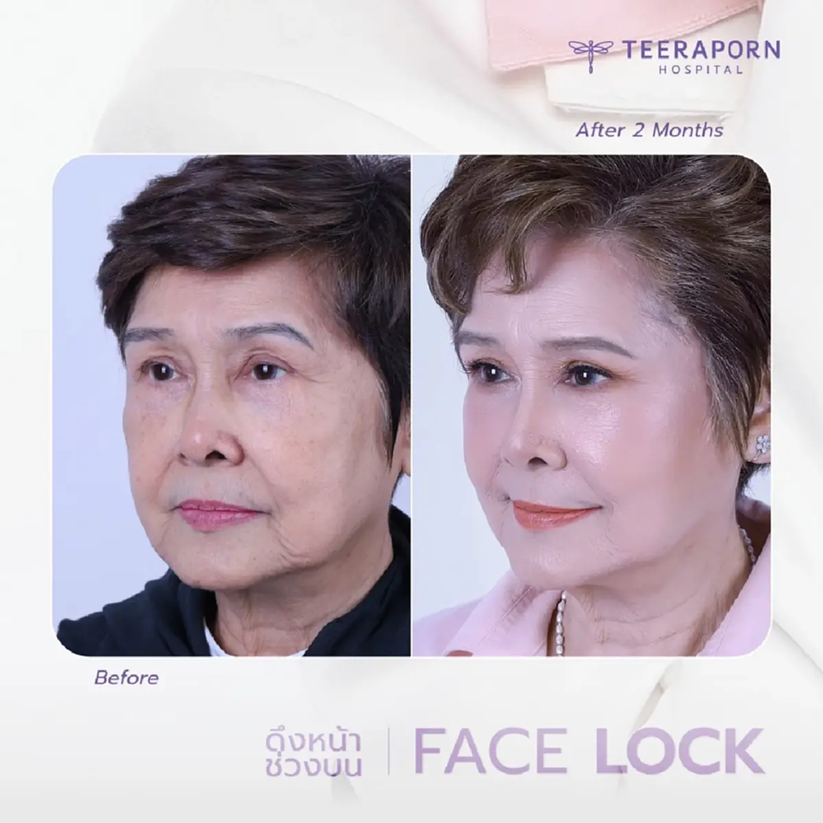 ว้าวทั้งโซเชียล นักแสดงรุ่นใหญ่ วัย 73 ปี สวยฉ่ำจำแทบไม่ได้