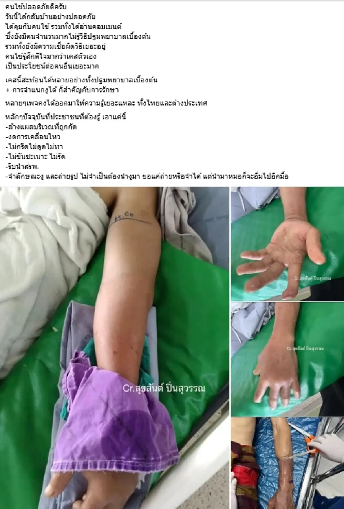 เปิดอาการล่าสุด เคสไวรัลงูกัด รัดแขนจนบวมหนัก หมอเตือนอย่าหาทำ