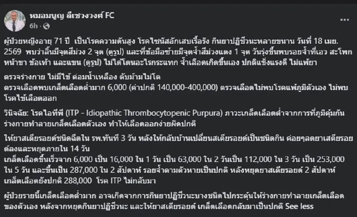 หญิงวัย 71 เจอ จุดสีม่วง ขึ้นลิ้น ก่อนสุดท้ายไปหาหมอ เจอเต็ม ๆ 