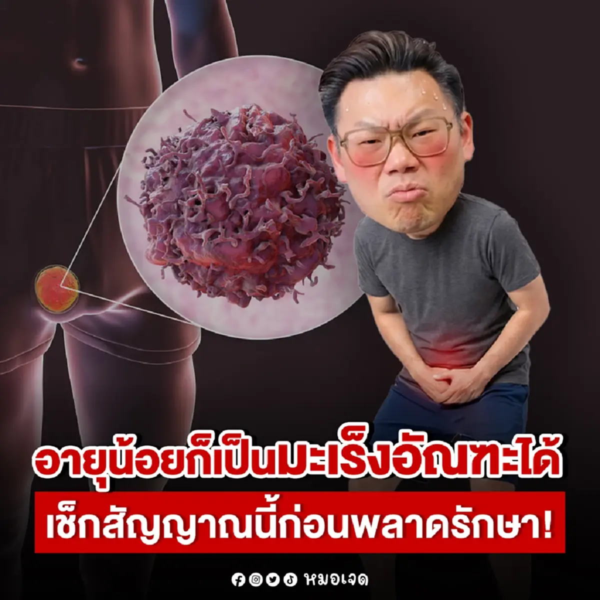 สะพรึง ชายอายุ 28 ตรวจเจอ "มะเร็งอัณฑะ" เพราะมองข้ามอาการสำคัญ