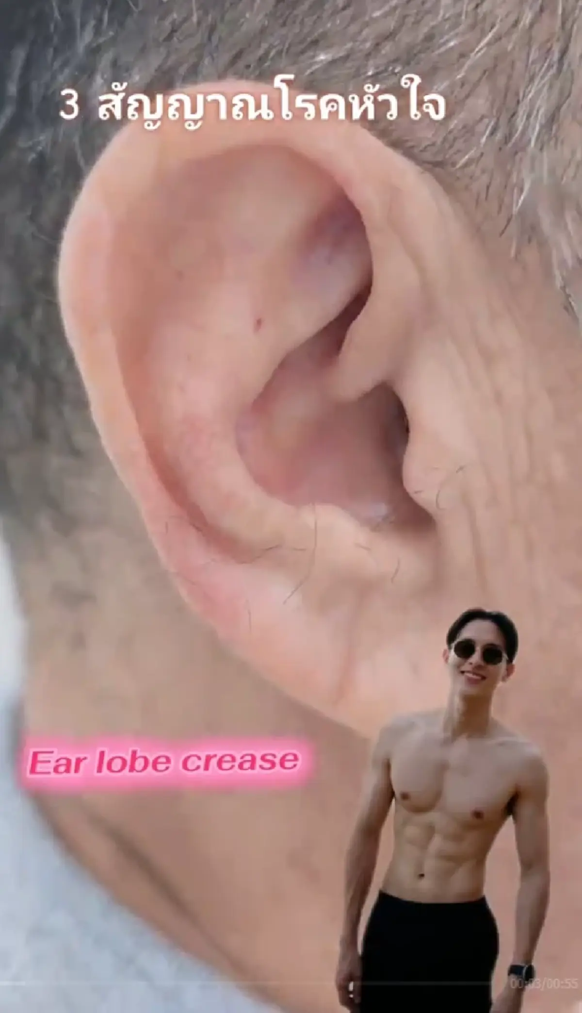 "เจมส์ จิรายุ" เจอเตือนตรงๆ หมอฝากเช็ก 3 อาการ หลังคอเลสเตอรอลพุ่ง