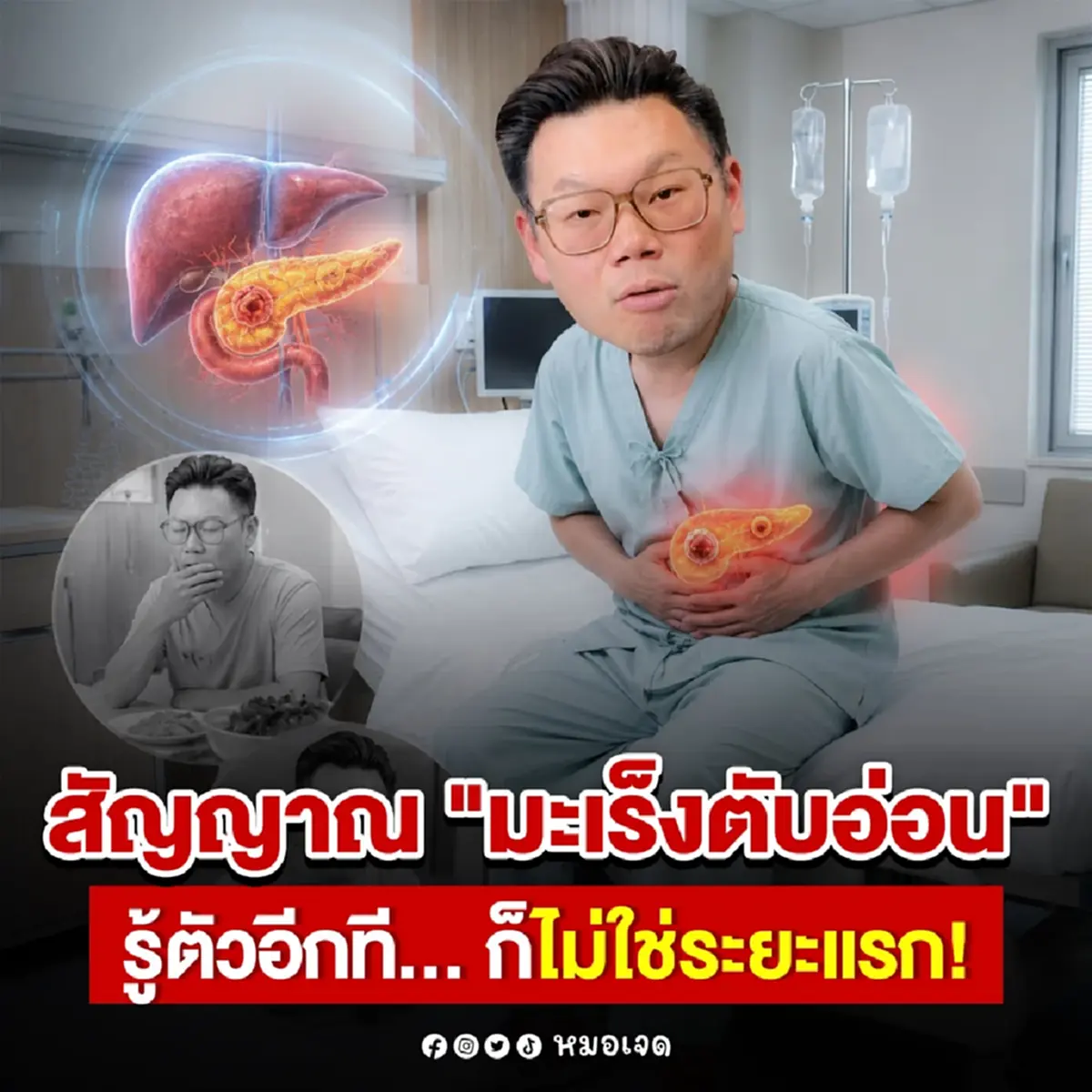 เปิดสัญญาณ "มะเร็งตับอ่อน" รู้อีกทีเลยระยะ 1 ไปแล้ว หมอยังกลัว 