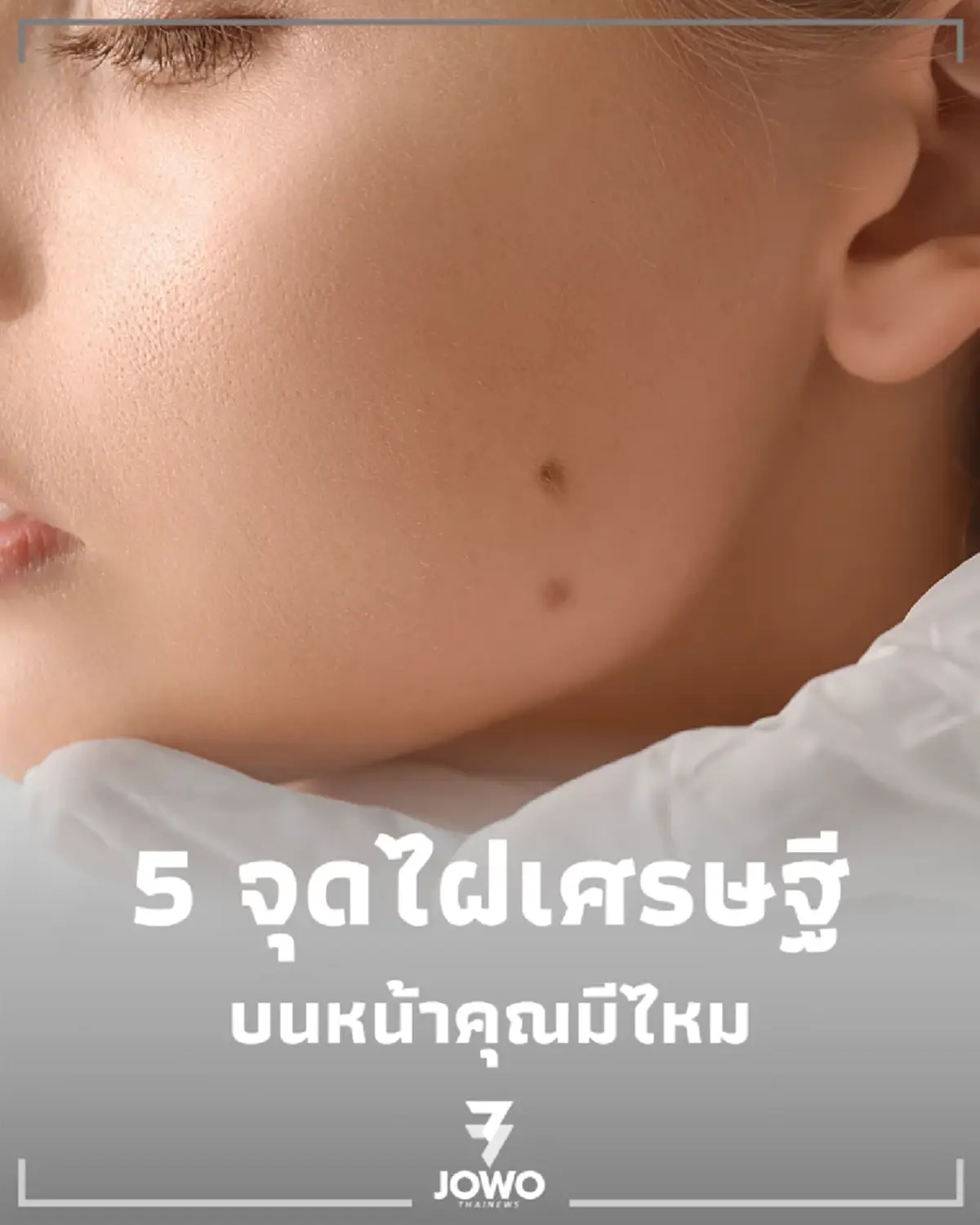 เปิด 5 จุดไฝ สัญลักษณ์แห่งความร่ำรวยและโชคลาภ