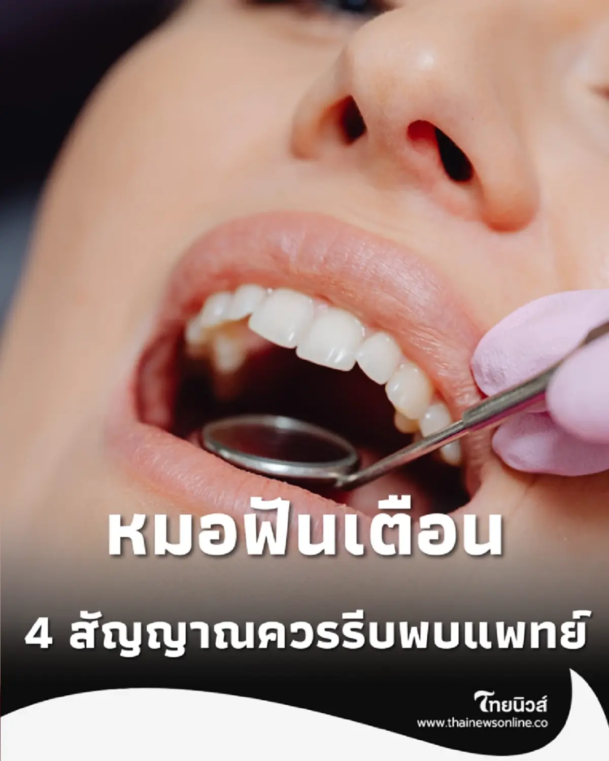 หมอฟันเผย 4 อาการเตือนมะเร็งในช่องปาก ถ้ามีแผลไม่หายรีบพบแพทย์