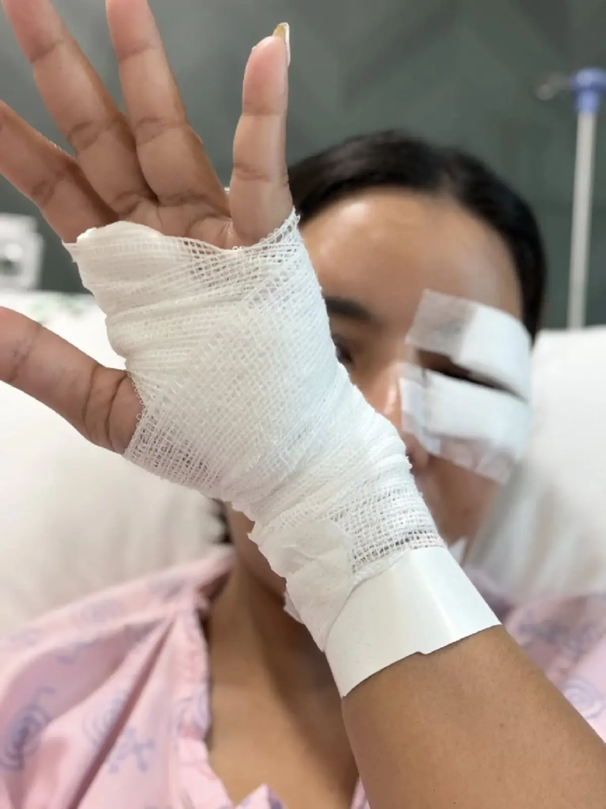 อุทาหรณ์ สาวให้อาหารหมาจร สุดท้ายโดนฝากเขี้ยวเย็บหน้า 50 เข็ม