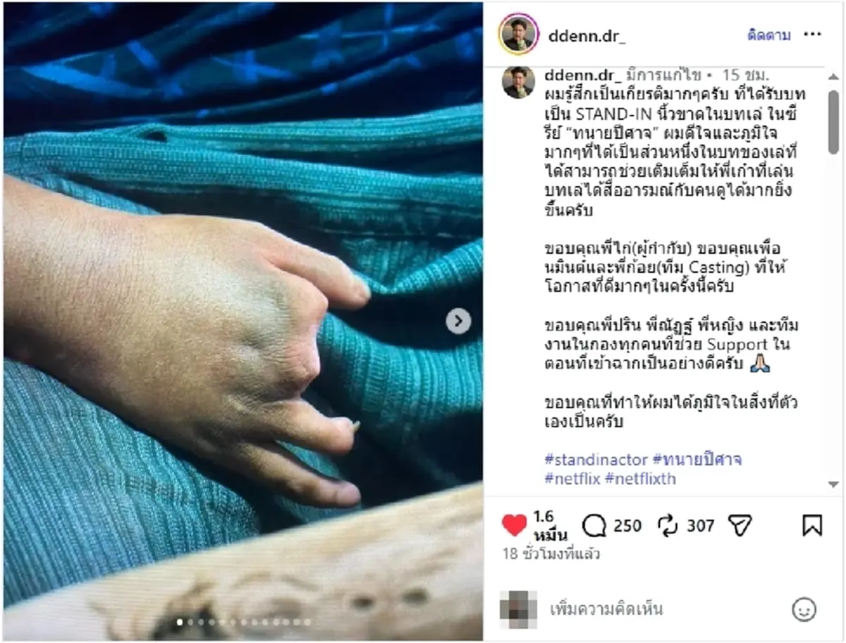 เปิดตัวสแตนด์อิน "นิ้วขาด" ทนายปีศาจ สุดภูมิใจ ได้ร่วมซีรีส์ดัง