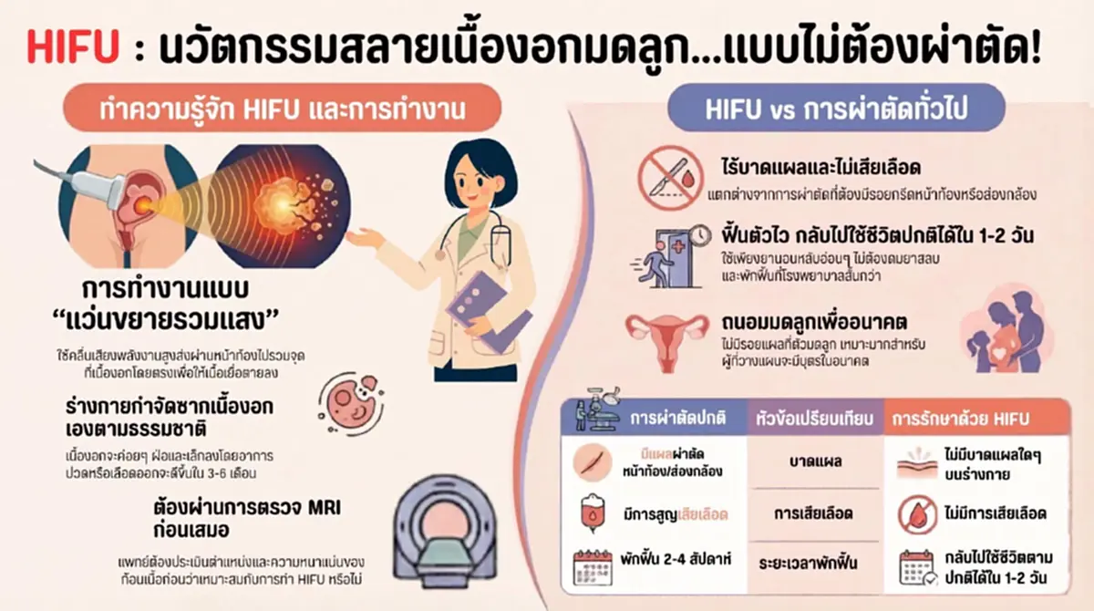 เปิดเกณฑ์คัดกรองผู้ป่วย HIFU ทางเลือกใหม่รักษาเนื้องอกมดลูก