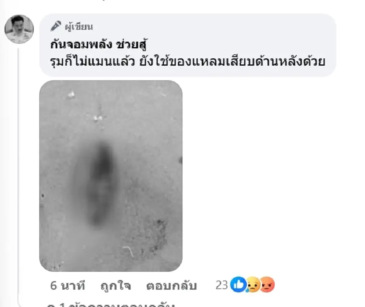 "กัน จอมพลัง" แฉตชด. โดนรุม 8 ต่อ 1 เจ็บสาหัสกรามหัก เย็บ 50 เข็ม