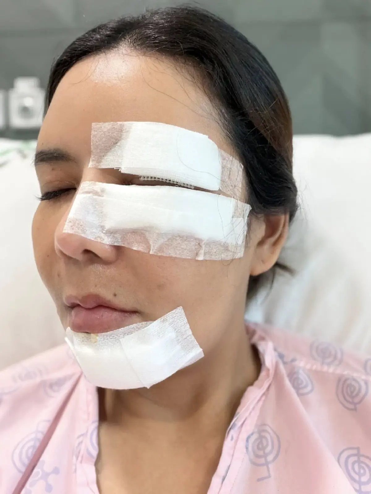อุทาหรณ์ สาวให้อาหารหมาจร สุดท้ายโดนฝากเขี้ยวเย็บหน้า 50 เข็ม