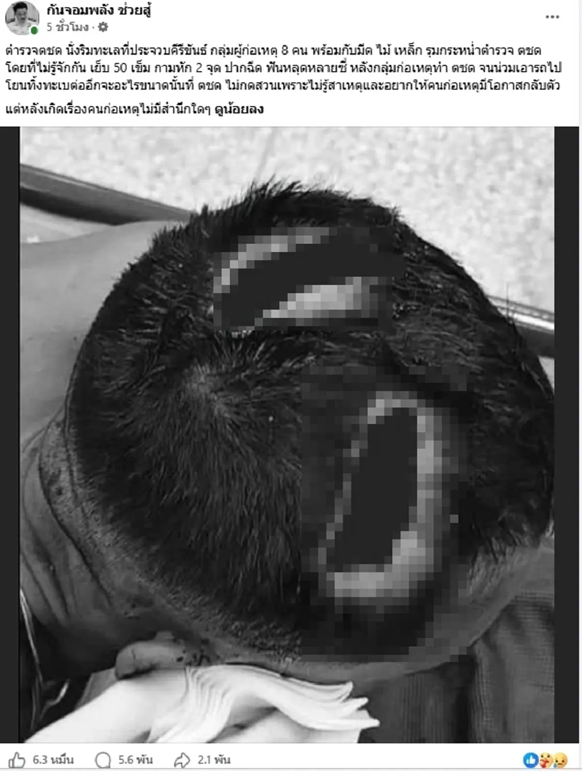 "กัน จอมพลัง" แฉตชด. โดนรุม 8 ต่อ 1 เจ็บสาหัสกรามหัก เย็บ 50 เข็ม