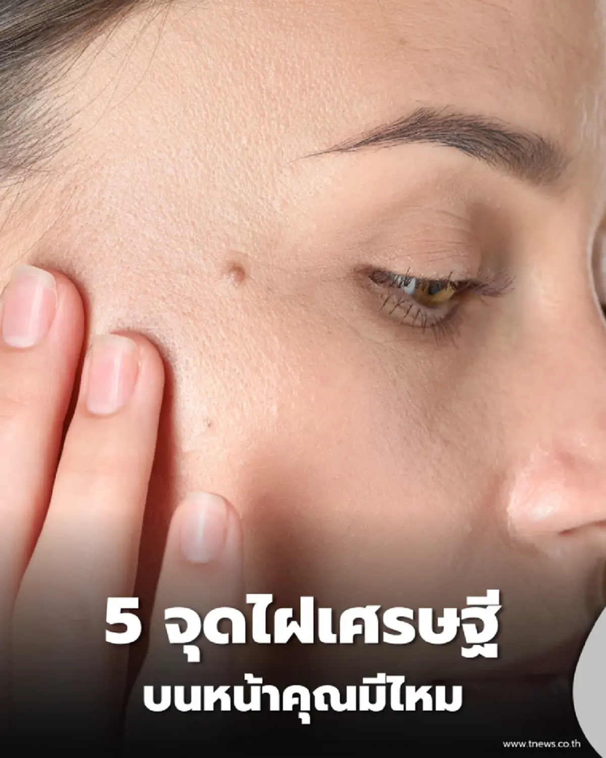 เปิด 5 จุดไฝ สัญลักษณ์แห่งความร่ำรวยและโชคลาภ
